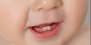 dentini-neonato